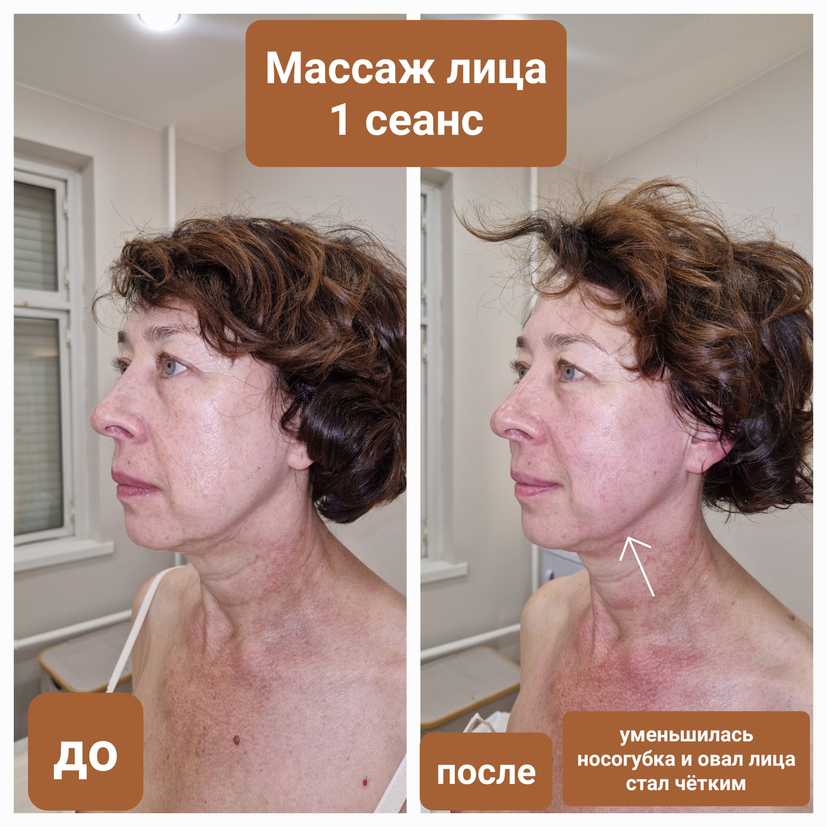 До и после массажа